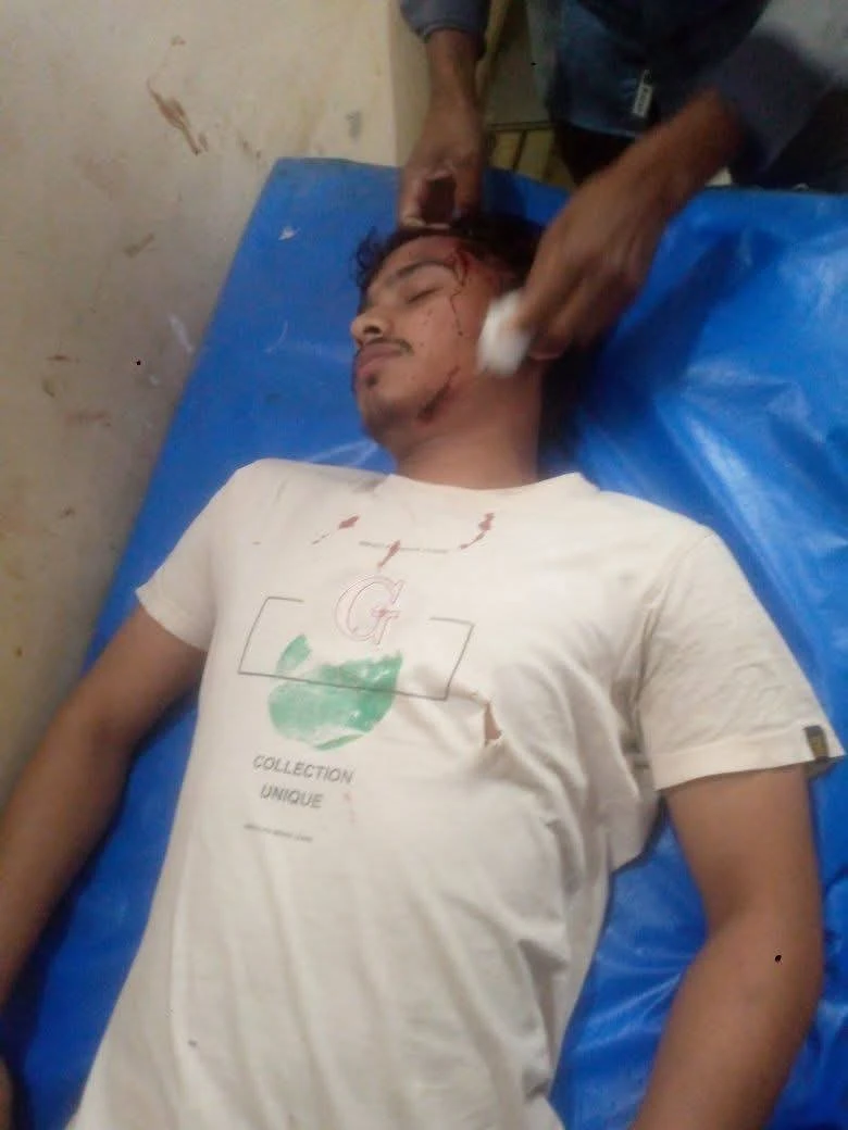 চায়ের দাওয়াতে ডেকে শিবির কর্মীর উপর হামলার অভিযোগ